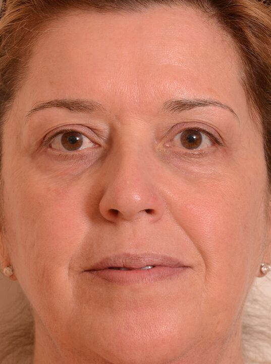 Ho ringiovanito il mio viso con la crema di eudalie