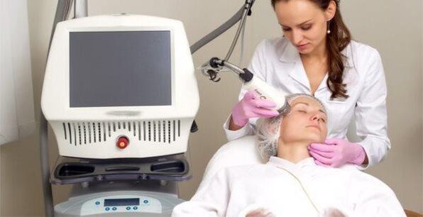 Eseguire la procedura