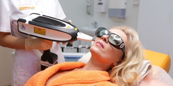 Sollevamento dopo trent'anni